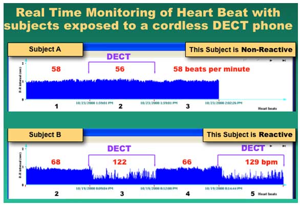 heart-beat-monitoring-chart-EndAllDisease