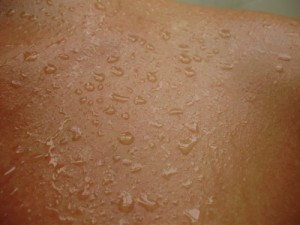 sweaty-skin