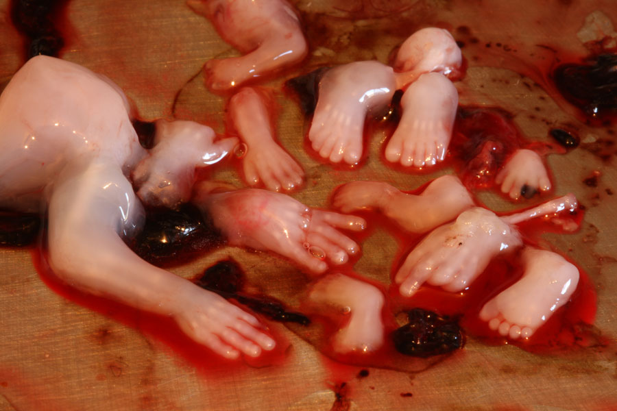 aborted fetus