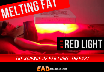 red light weight loss liposuction